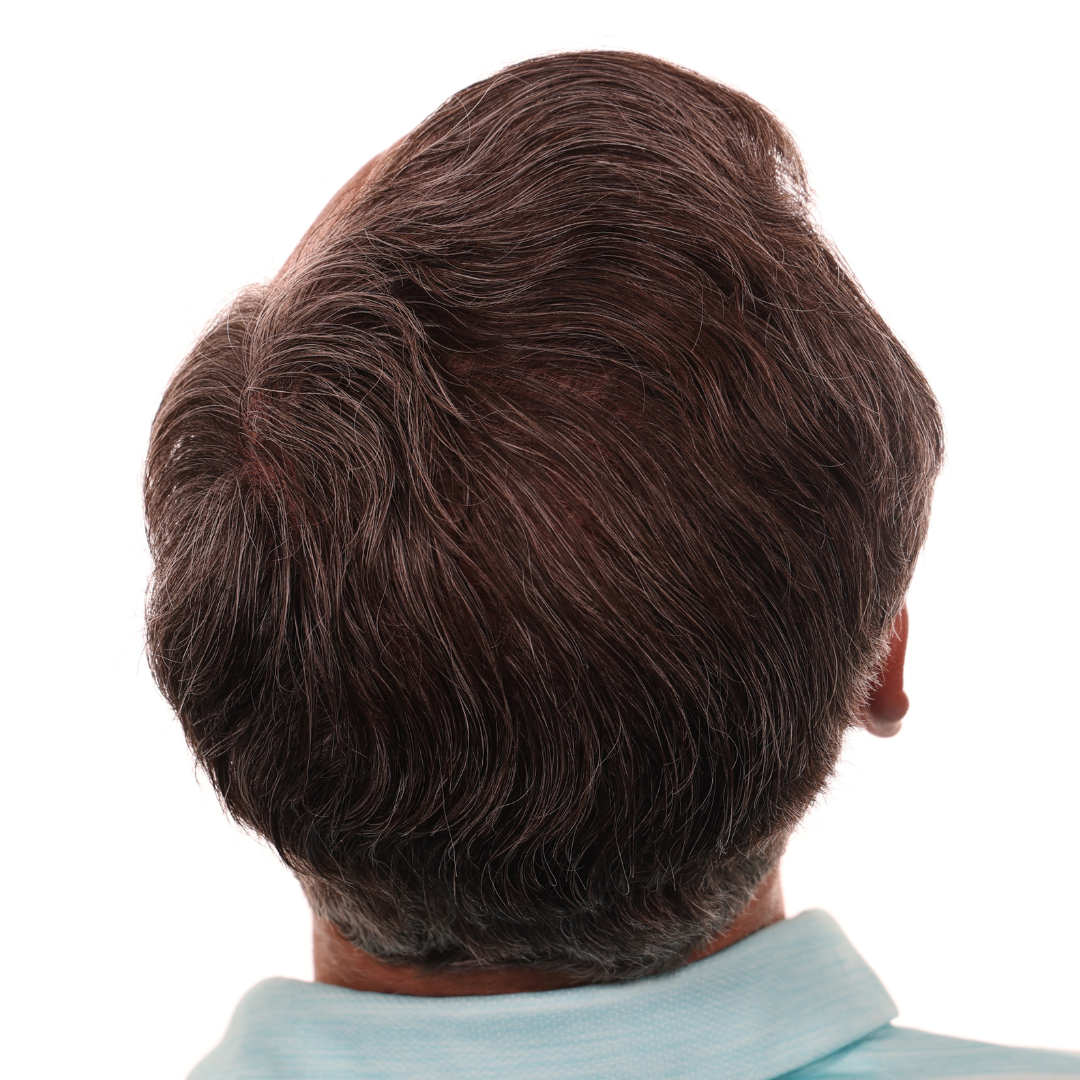 brian-taylor-back-tilt-after-2