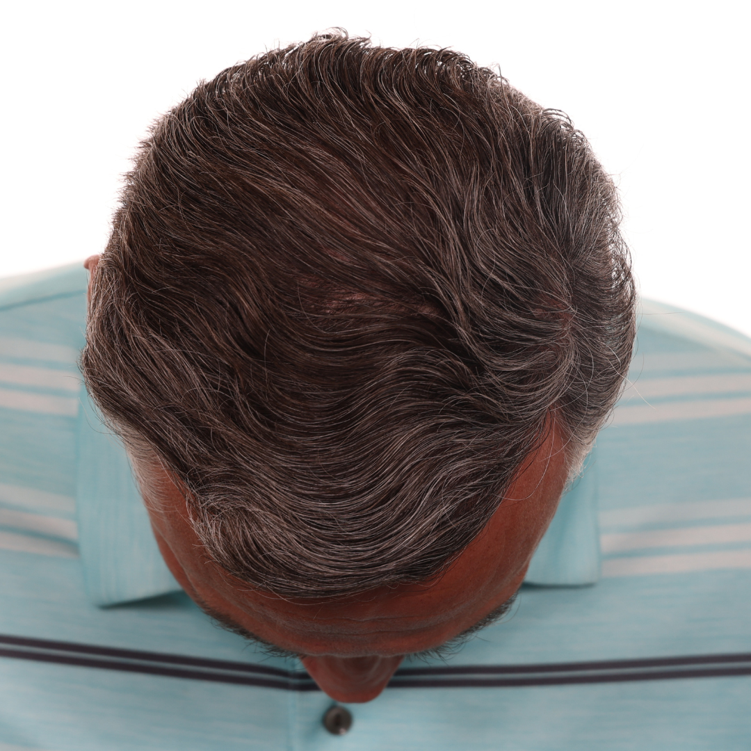 brian-taylor-front-tilt-after