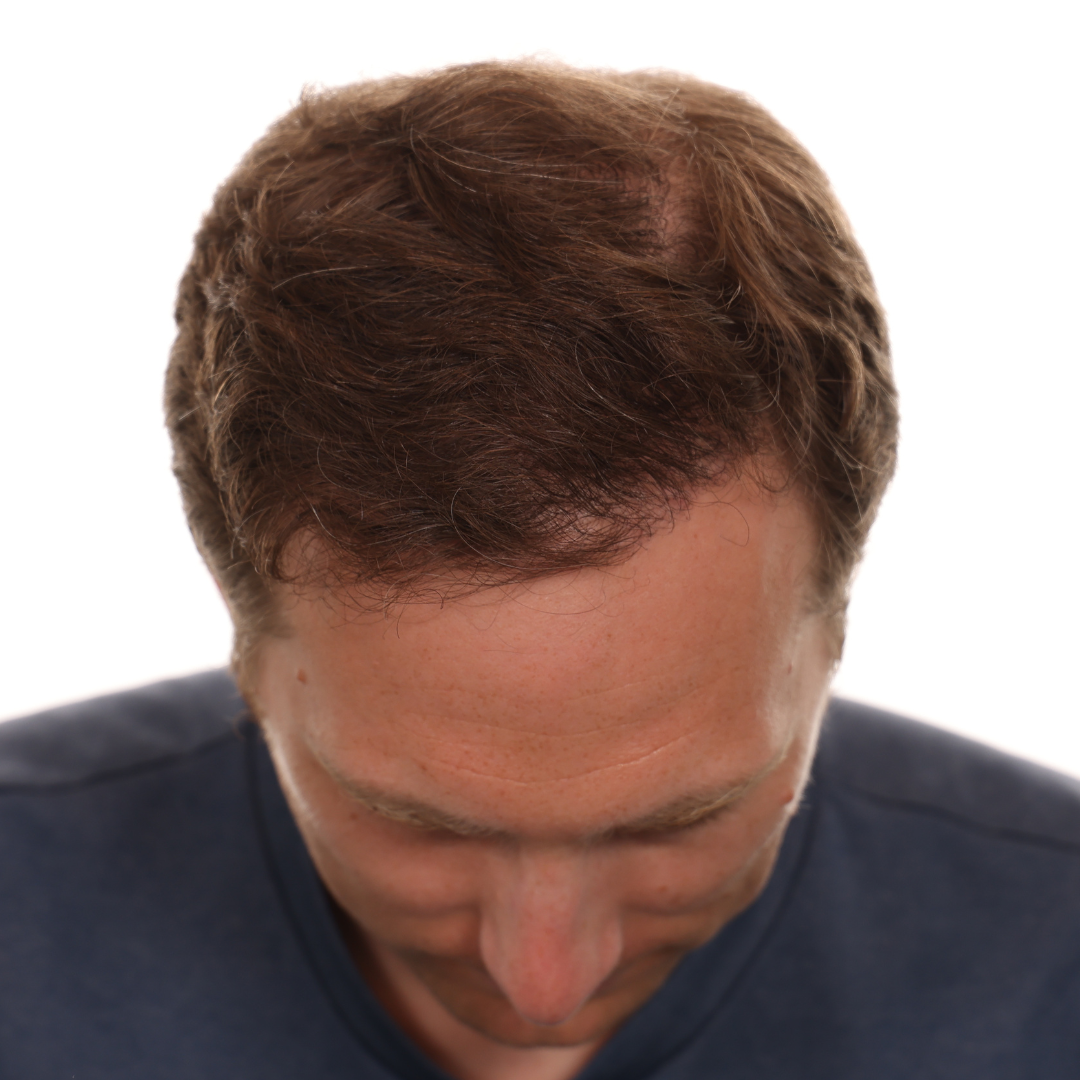 cole-jackson-front-tilt-after