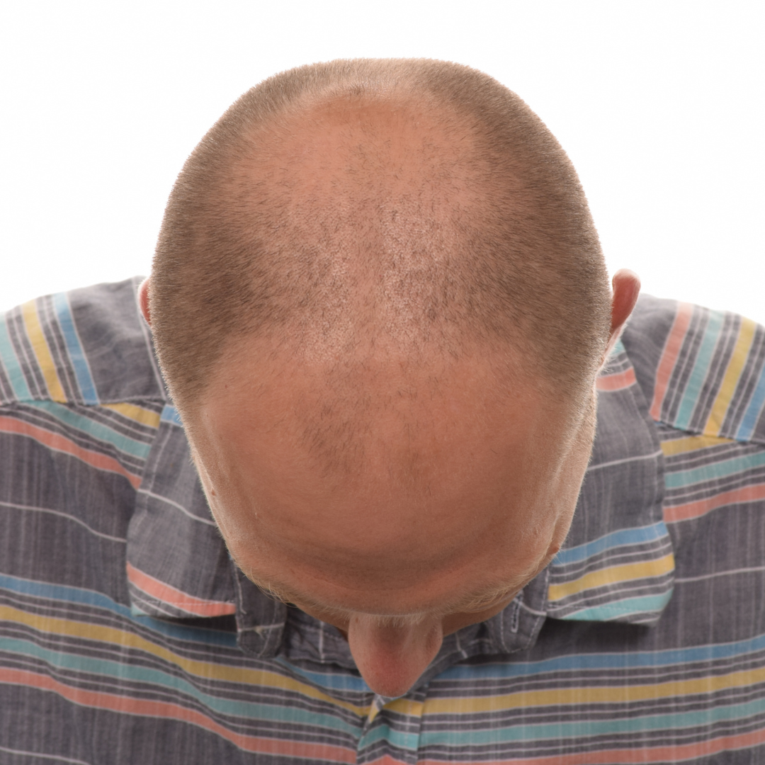 cole-jackson-front-tilt-before