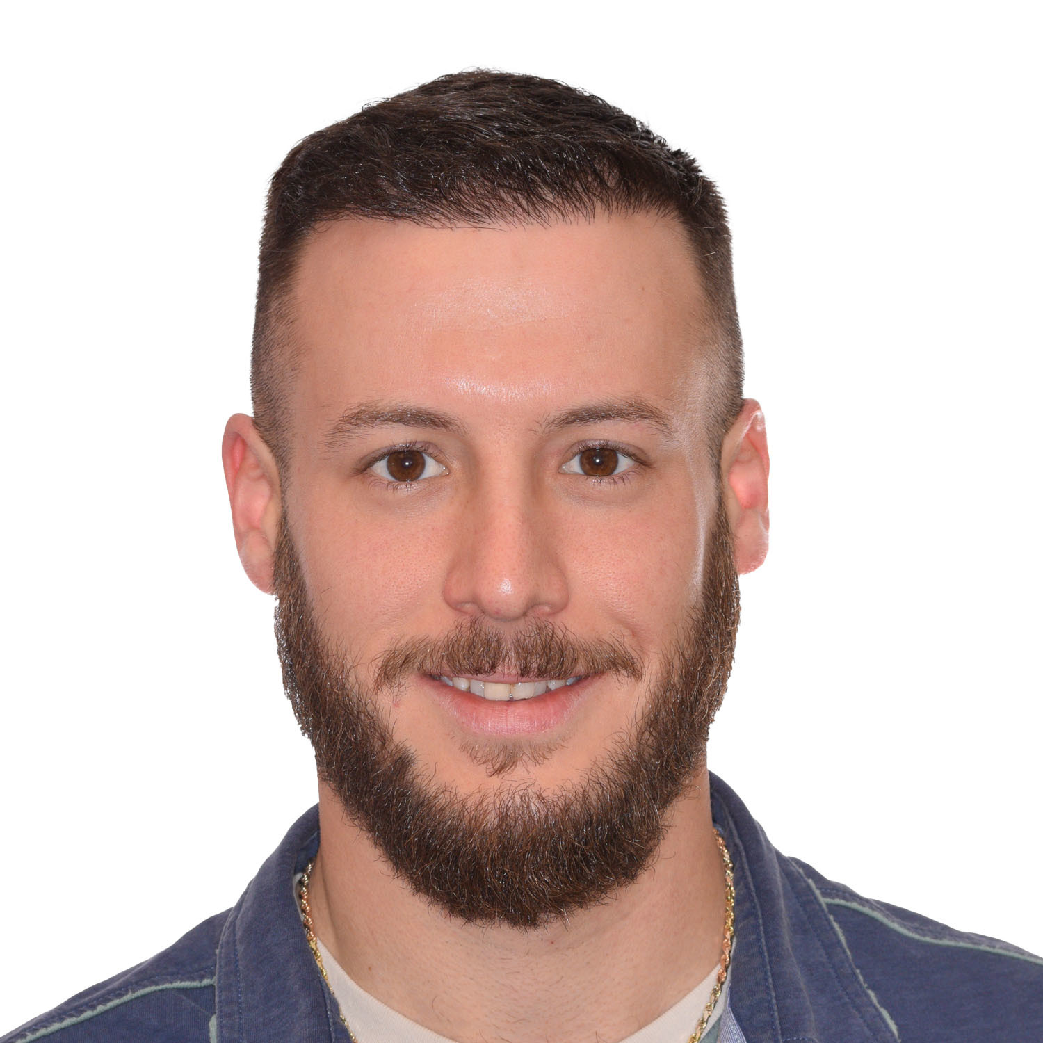 Nick After FUE Hair Transplant