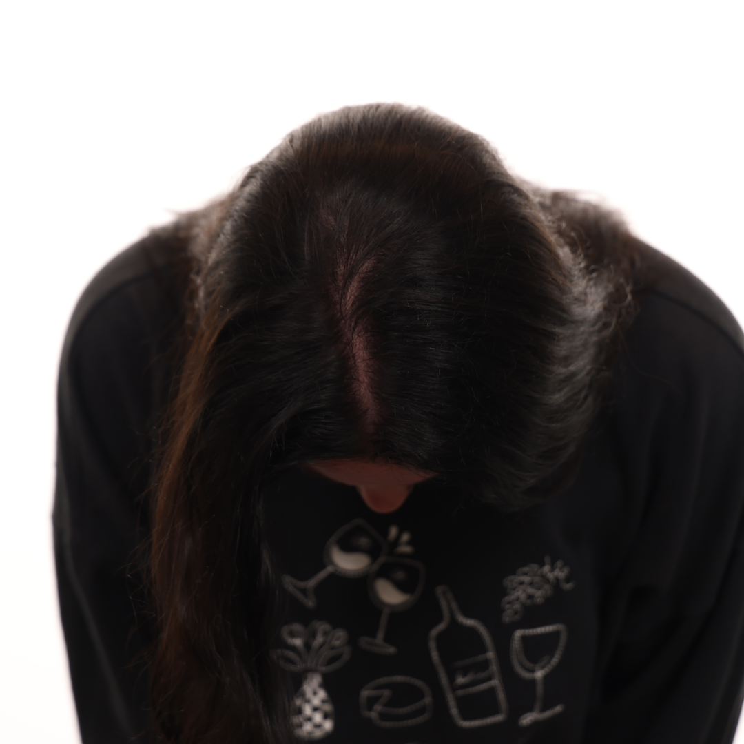katelyn wampner laser hair therapy before and after