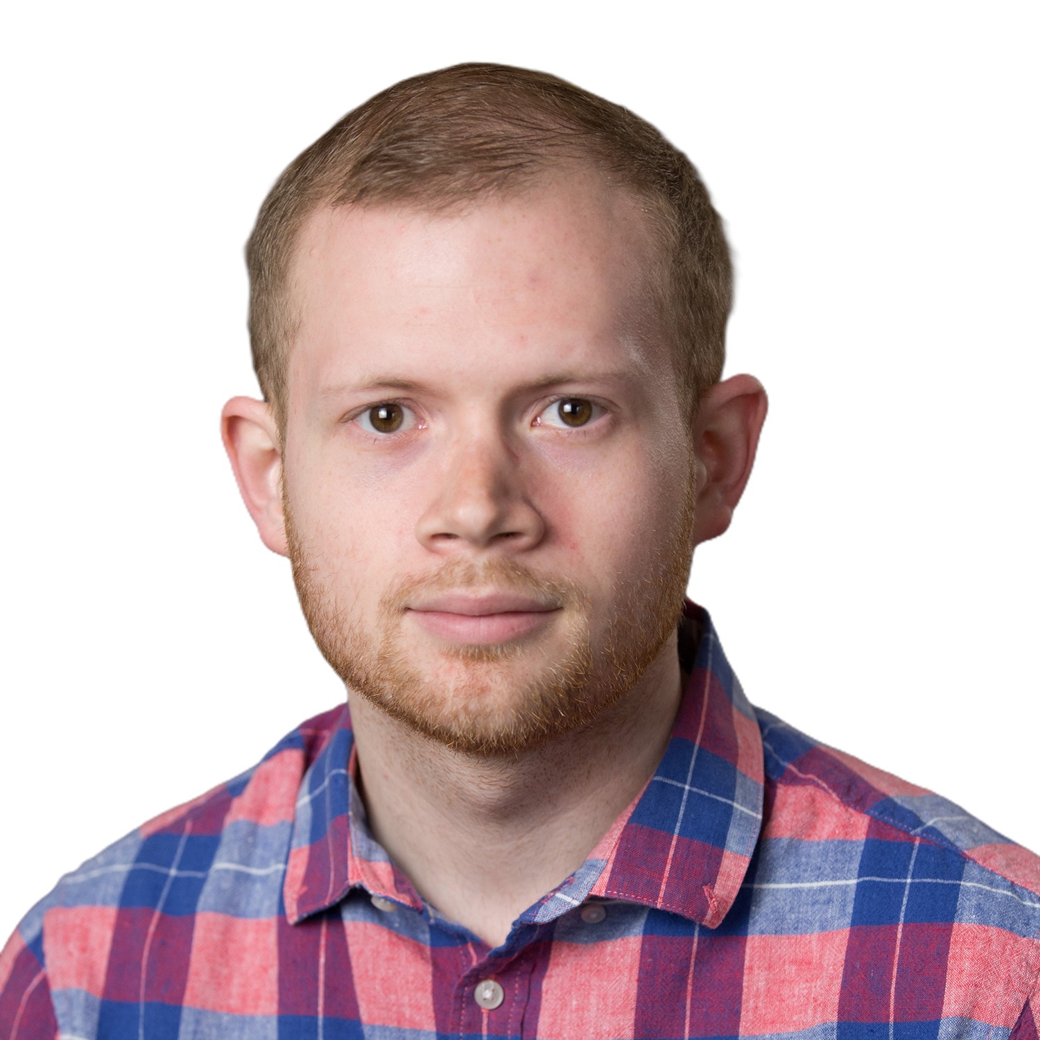 Andrew S., front view before treatment