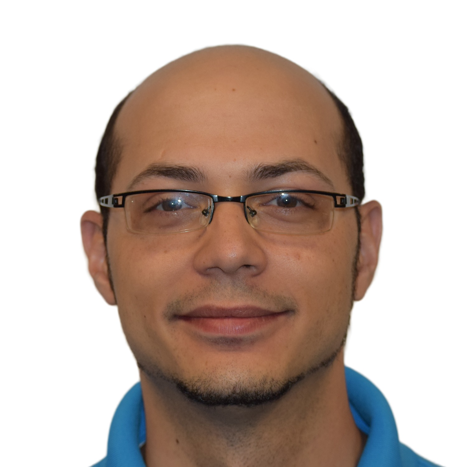 Bryan, front view before treatment