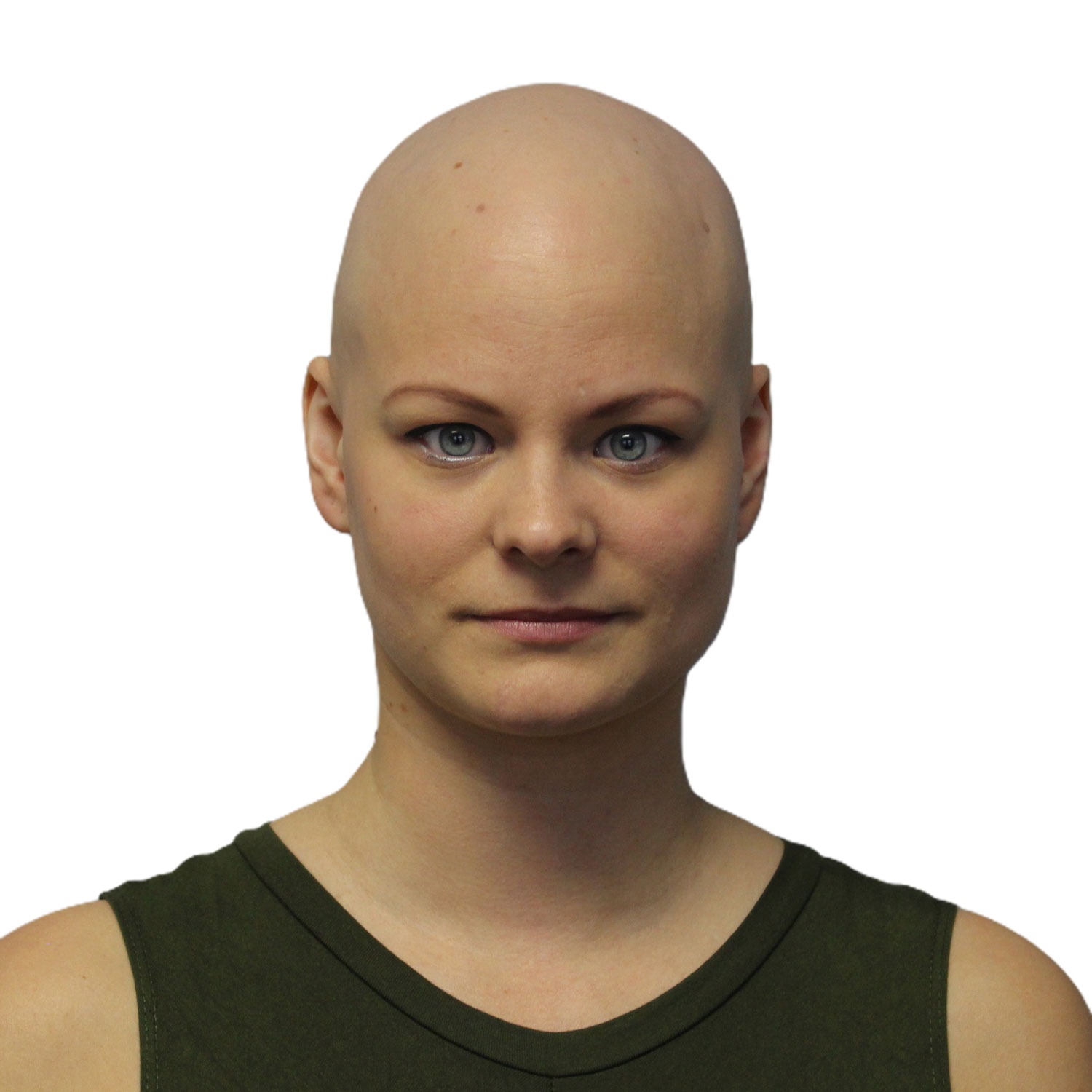Malin, front view before treatment